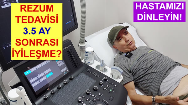 rezum hasta yorumlari youtube playlist