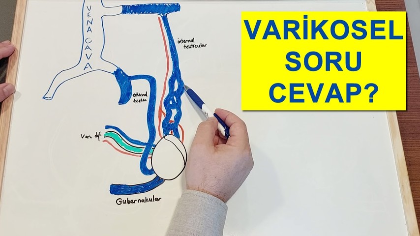 varikoselSSS youtube playlist